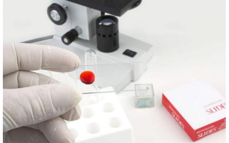 上海甲醛檢測(cè)機(jī)構(gòu)電話